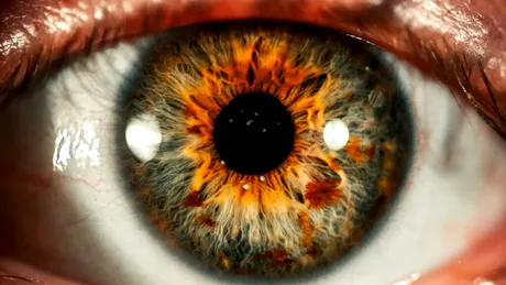 Un medicament pentru cataractă a arătat rezultate promițătoare în testele de laborator