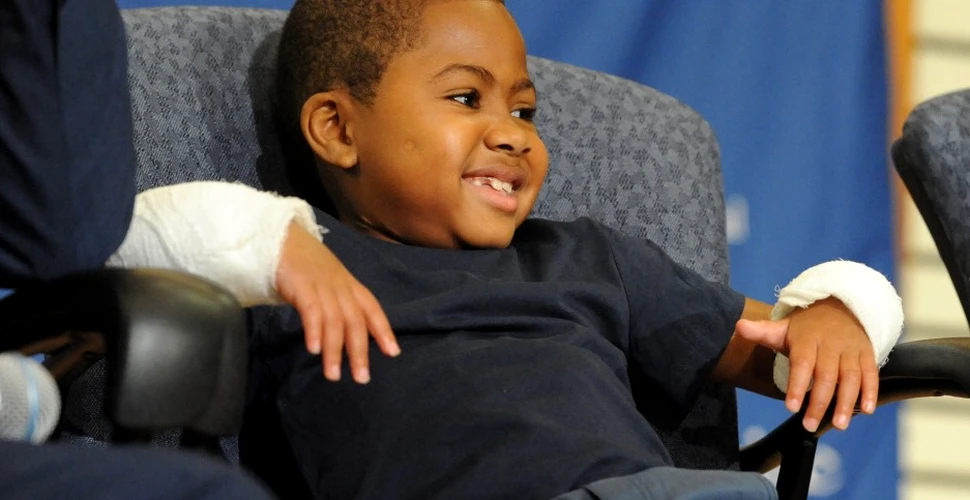 El este Zion Harvey, un băiat de opt ani din SUA care a rămas fără mâini şi fără picioare din cauza unei infecţii grave. Miracolul reuşit de medici