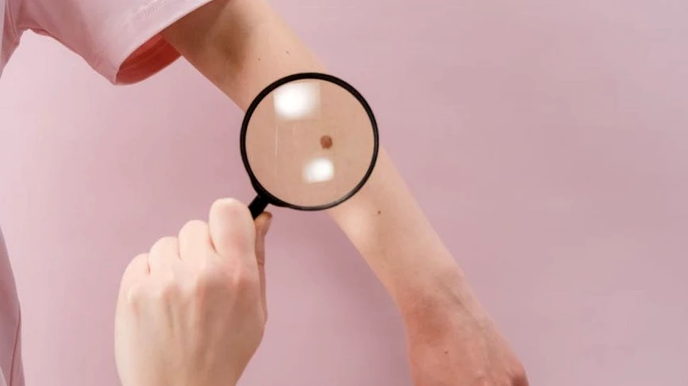 Cercetătorii au descoperit o substanță care oprește creșterea tumorilor