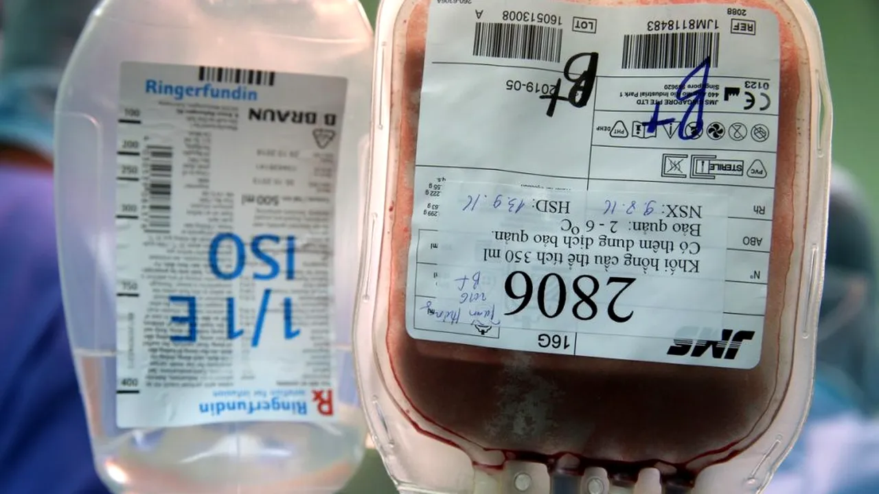 Operating theater. blood transfusion. 