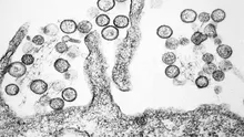 Focar mortal de hantavirus pe un vas de croazieră din Atlantic