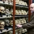 „Camera craniilor” de la Universitatea din Edinburgh dezvăluie o istorie neplăcută