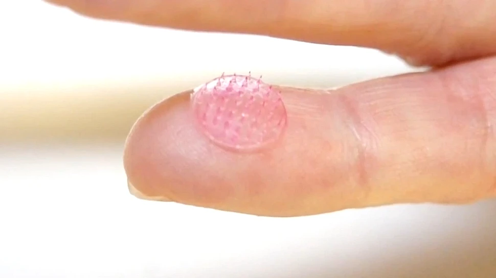 Inovaţia care elimină durerea: a fost creat vaccinul care pătrunde în corp fără ace (VIDEO)