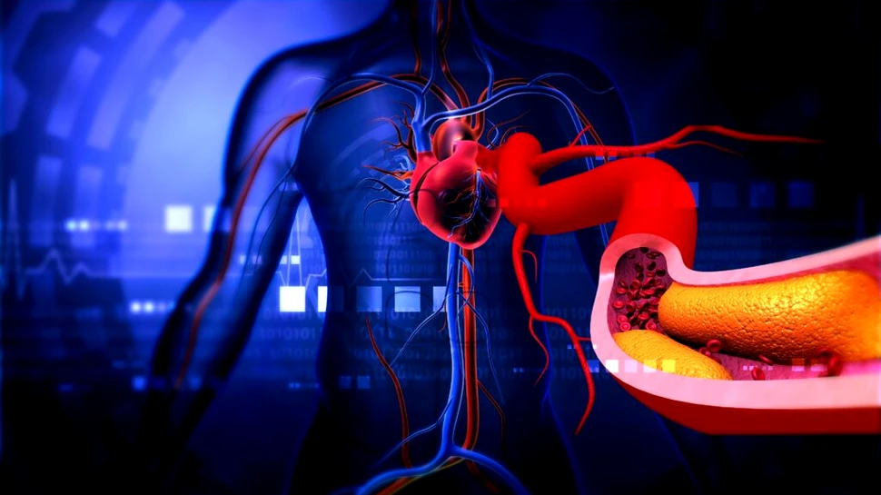 De ce colesterolul nu este doar „problema oamenilor supraponderali”?