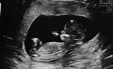 Pentru prima dată în istorie, Inteligența Artificială și robotică de ultimă generație au creat o sarcină umană