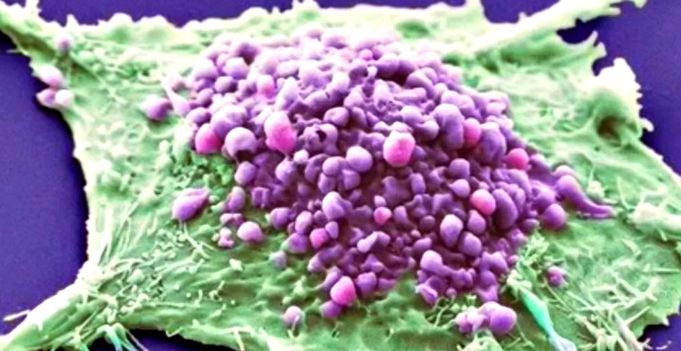 Pas URIAŞ! Oamenii de ştiinţă au efectuat primele teste ale unui vaccin universal pentru toate tipurile de cancer – FOTO+VIDEO