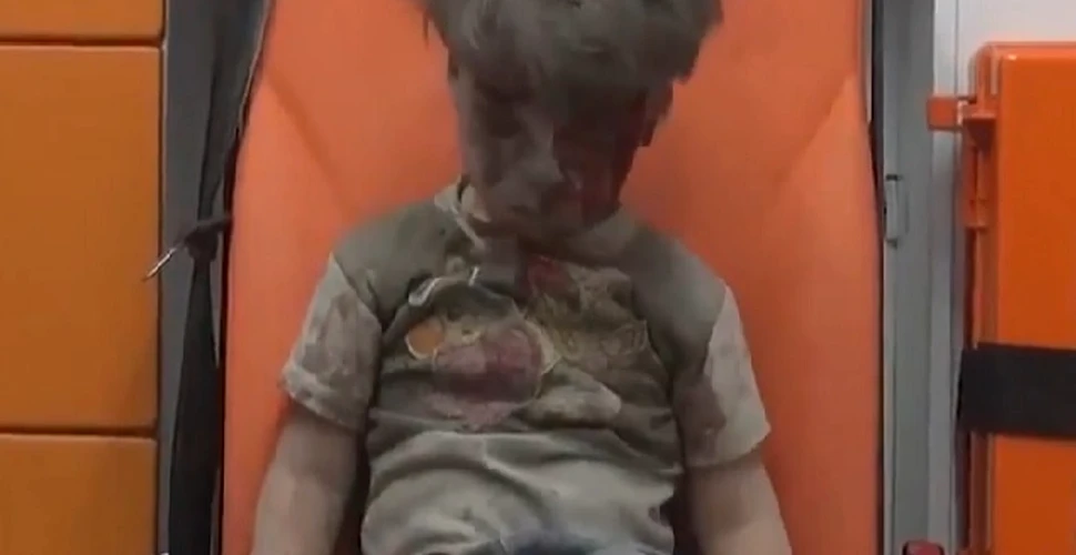 Scrisoare emoţionantă: Un copil din Statele Unite îi cere lui Obama să-i aducă acasă băieţelul din Siria rănit în urma unui bombardament – FOTO