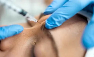 Putem preveni ridurile dacă injectăm botox de la 20 de ani?