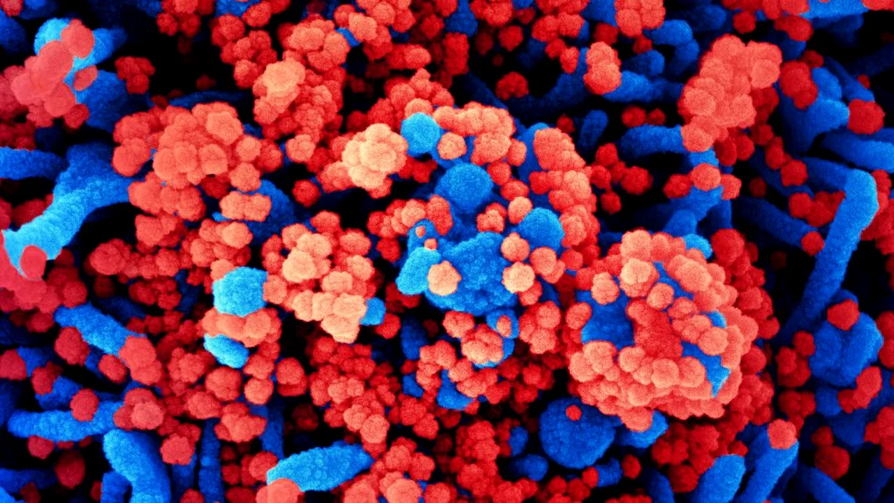 coronavirus-celule-covid-niaidflickr_Descopera 