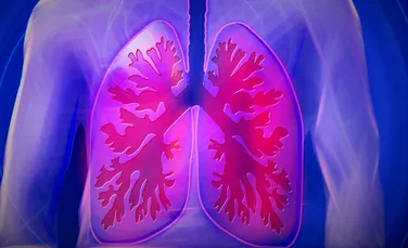 Algoritmii pot fi folosiţi pentru a detecta ADN-ul cancerului pulmonar în mostrele de sânge