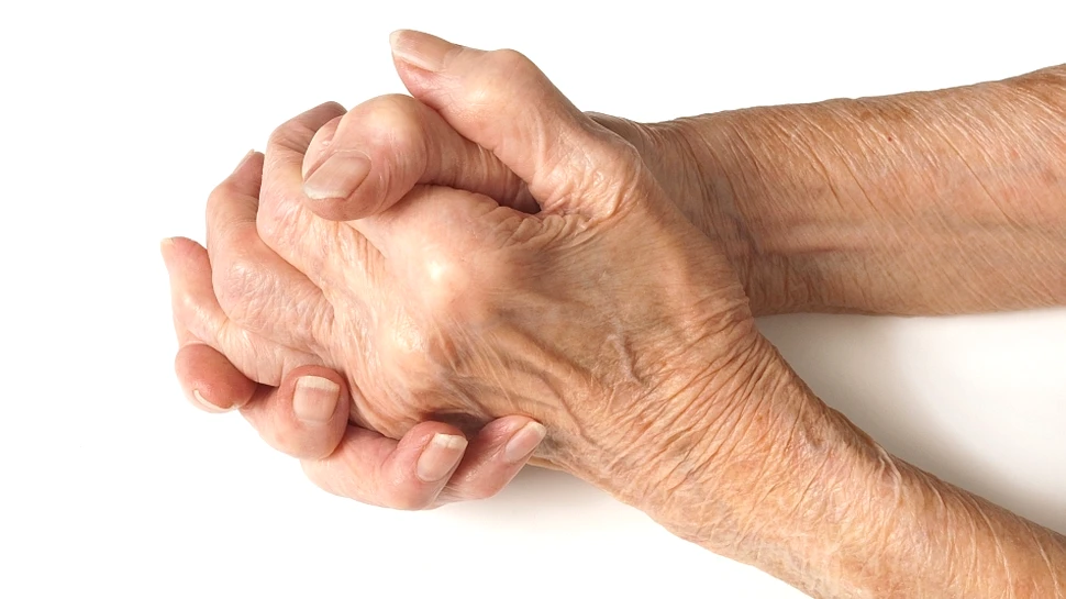 Lucrul esenţial pe care trebuie să îl facă fiecare om pentru a preveni artrita