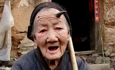Unei chinezoaice centenare i-a crescut un corn in frunte (FOTO)