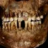 O femeie aristocrată din secolul al XVII-lea își lega dinții cu sârmă de aur, au descoperit cercetătorii