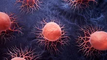Tot mai mulți nefumători fac cancer pulmonar. Care este motivul?