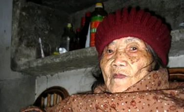 Femeia care a ţinut un făt în pântec timp de 60 de ani