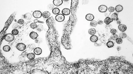 Focar mortal de hantavirus pe un vas de croazieră din Atlantic