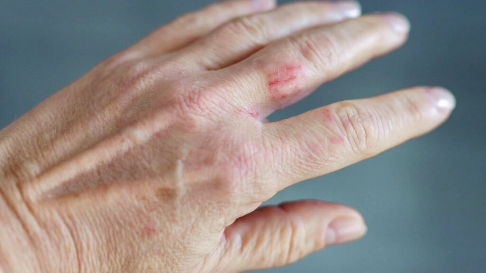 Mâinile nu mint? Noua obsesie din industria frumuseții mută atenția dincolo de pielea feței