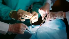 Un bărbat a primit un transplant de rinichi în timp ce era treaz