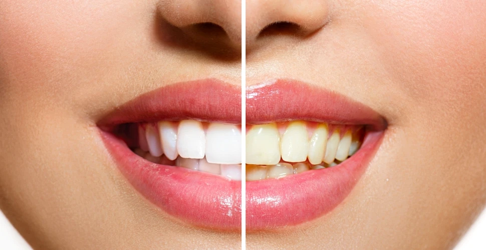 Trucurile simple care vă asigură un zâmbet perfect. Ce sfaturi dau stomatologii?