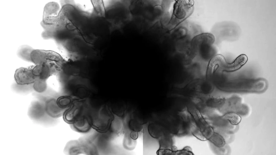 Cercetătorii au reprodus la scară microscopică plămâni umani cu ajutorul celulelor stem