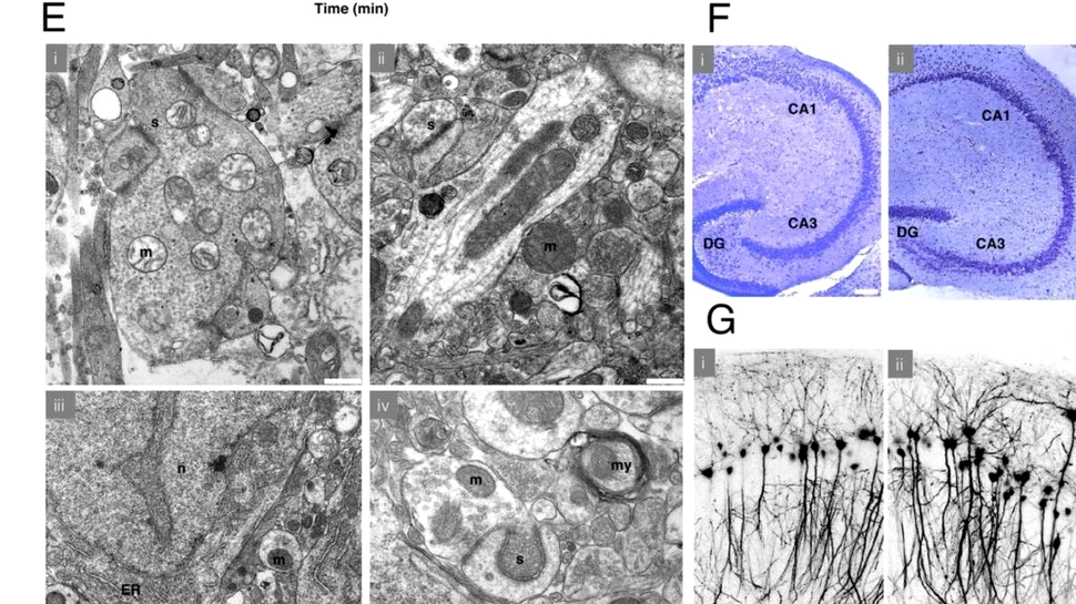 Poate fi readus la viață un creier crioconservat? Iată ce au arătat noi experimente!