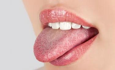 Care sunt cauzele candidozei bucale şi cum o tratăm