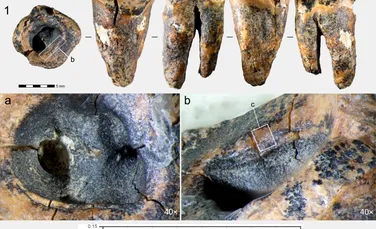Unde practicau neanderthalienii stomatologia acum 60.000 de ani?