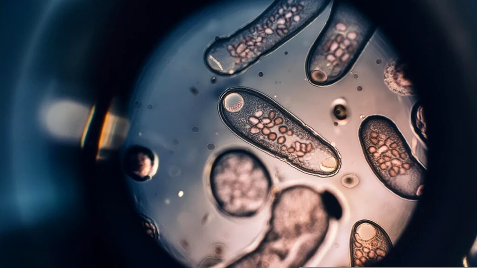 Inteligența Artificială poate detecta acum și infecțiile cu viermi paraziți