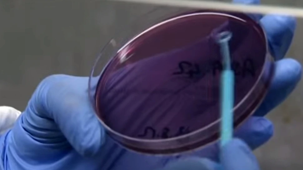 Ţara cu cea mai mare epidemie de rujeolă din lume