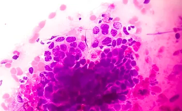 Un nou vaccin împotriva cancerului a blocat tumorile la șoareci