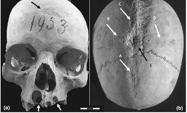 Ce reprezintă semnele în formă de cruce găsite pe craniul unei femei din perioada bizantină?