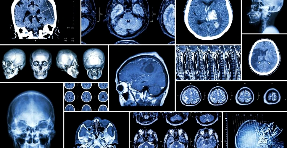 O nouă hartă detaliată a sistemului nervos a fost creată: poate oferi noi indicii cu privire la originea unor boli neurologice