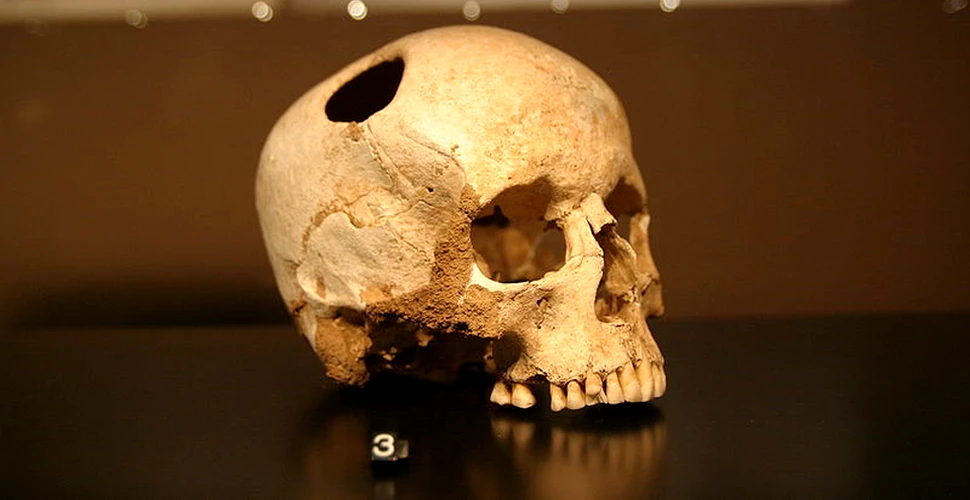 Analizarea a 800 de cranii scoate la iveală faptul că medicii din Imperiul Incaş erau mai buni decât cei din timpul Războiului Civil American