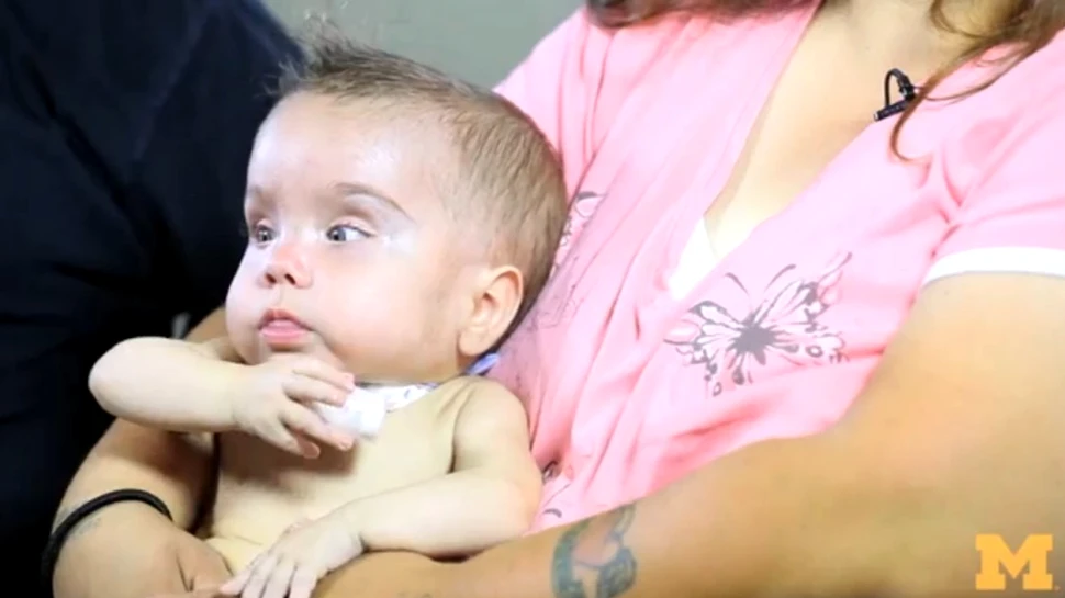 Imprimantele 3D salvează vieţi: un bebeluş a supravieţuit mulţumită unui dispozitiv medical printat 3D (VIDEO)