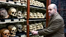 „Camera craniilor” de la Universitatea din Edinburgh dezvăluie o istorie neplăcută