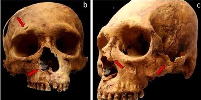 Ce au descoperit arheologii după ce au analizat scheletele unor oameni din 400 î.Hr.