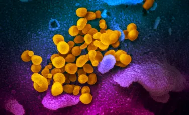 Coronavirusul supravieţuieşte la temperaturi de peste 60 de grade – studiu francez