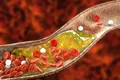 Oamenii de știință au descoperit că sistemul imunitar al ficatului poate să mănânce „colesterolul rău”