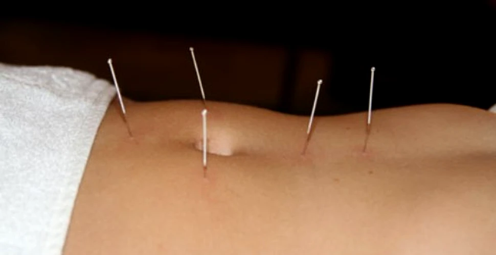 A fost descoperit secretul acupuncturii