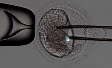 Premieră medicală: procedura de fertilizare in vitro cu trei persoane dă speranţă cuplurilor total infertile