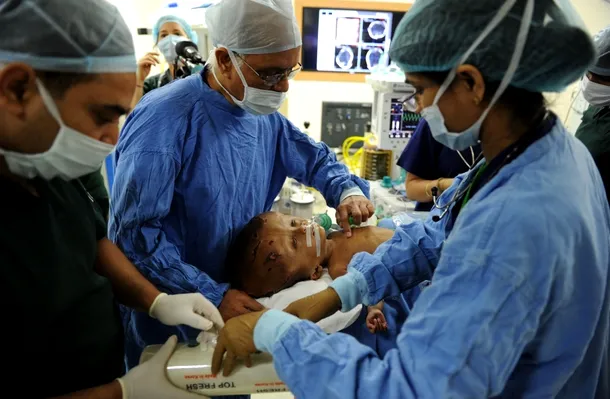 Intervenţie medicală de succes: fetiţa cu cap gigantic a fost operată