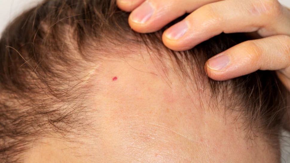 Un studiu arată modul surprinzător în care crește părul