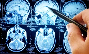 Oamenii de știință descoperă un circuit cerebral care poate opri durerea cronică