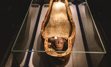 Tumoare făcută din dinți, găsită în pelvisul unei femei din Egiptul antic