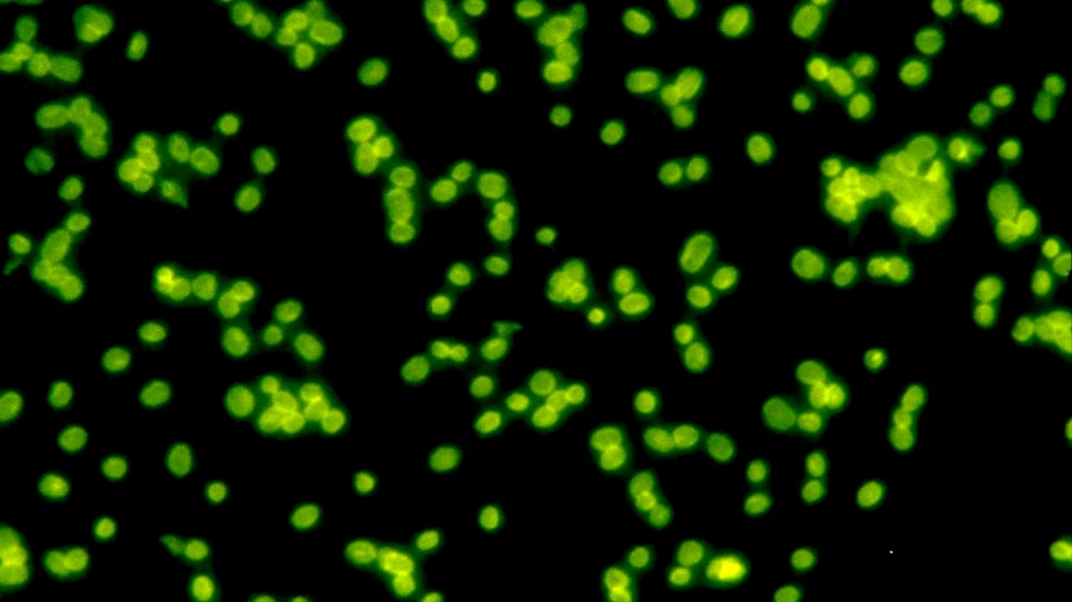 Un studiu demonstrează că aceste organisme terestre ar putea supravieţui pe Marte