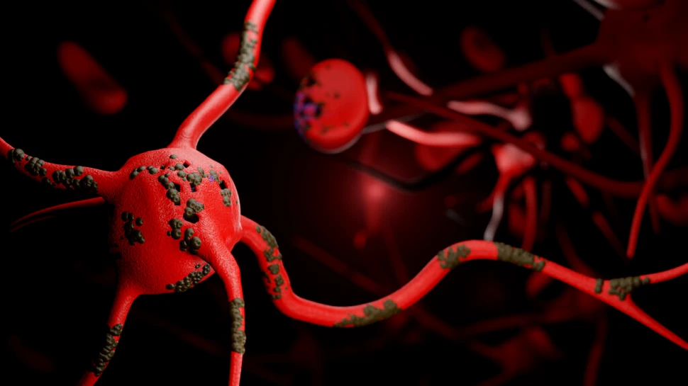 O boală neurologică rară se răspândește în cea mai populată țară a lumii