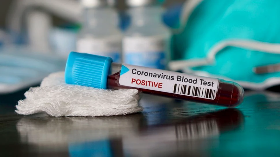 Un potenţial vaccin contra coronavirusului ar putea fi dezvoltat în 16 săptămâni