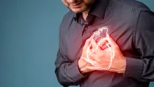 Test de cultură generală. Ne doare întotdeauna în piept atunci când facem infarct?