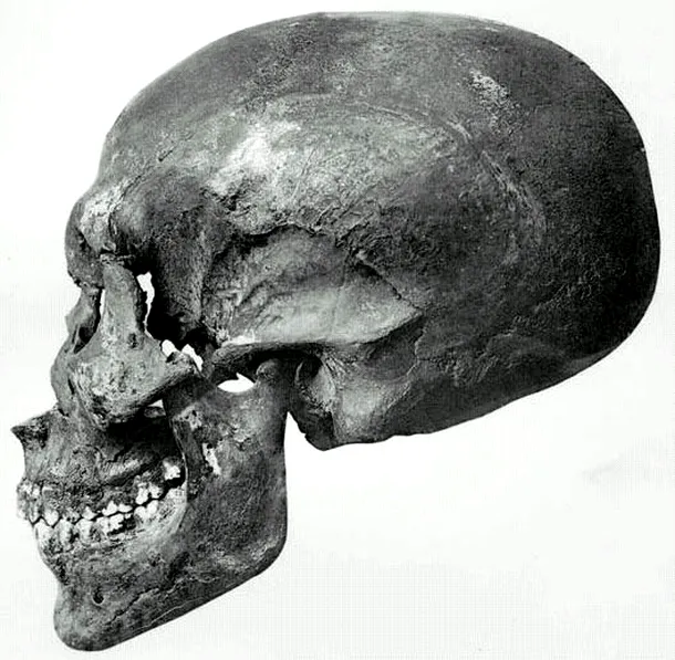 Craniul faraonului Akhanton, mutilat