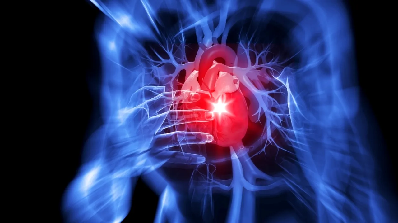 1-infarct 